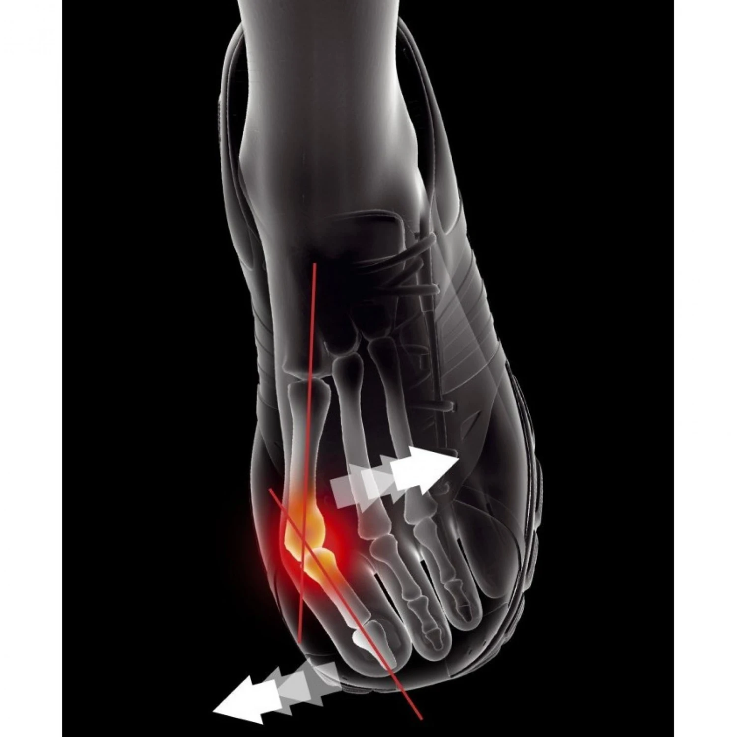 Voetbescherming Epitact Hallux Valgus 4 Voetbescherming Epitact Hallux Valgus - Afbeelding 2